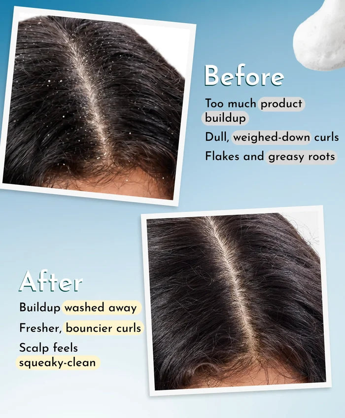 Clarifying Shampoo (100 ML)