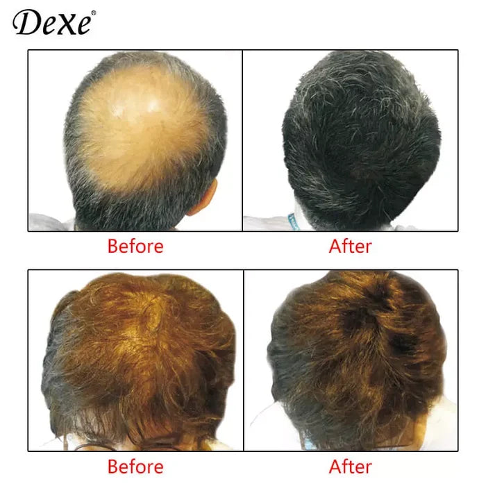DEXE Hair Building Fiber & Hair locking spray (22g/100ml) black