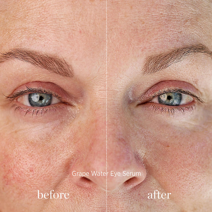 Before and after shot of using Ere Perez Grape Water Eye Serum.