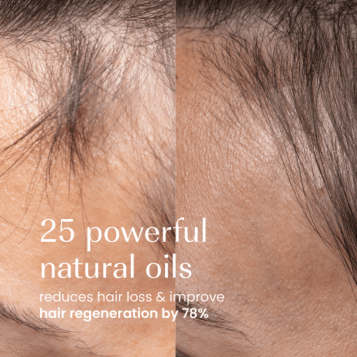 Izil Beauty Densify Strengthening Hair Oil 190ml - Beauty Tribe