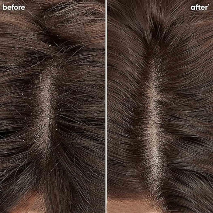 Matrix Biolage Advanced Scalppure Dandruff Conditioner (98Gm)