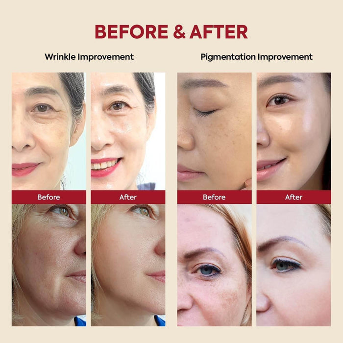 Seoul 1988 Retinal Serum – 2% Retinal Liposome + Black Ginseng - Retinal Serum - K-SECRET -- United Arab Emirates -- Pinky Cosmetics